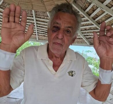Empresario tabaquero de Altamira es brutalmente golpeado durante asalto en su residencia