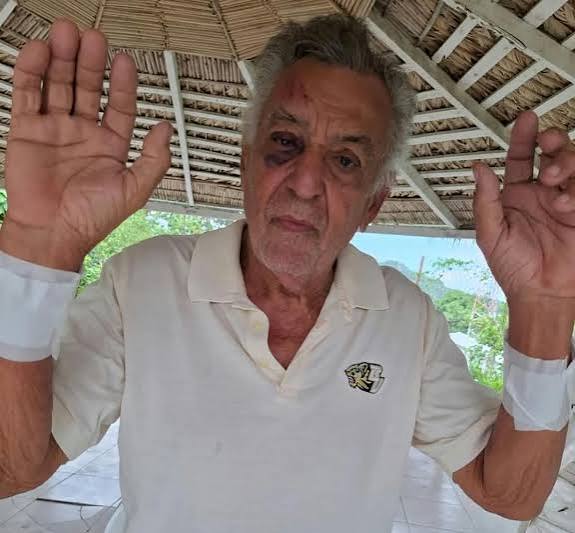Empresario tabaquero de Altamira es brutalmente golpeado durante asalto en su residencia
